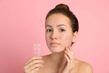 10 Cara Hilangkan Bekas Jerawat dengan Bahan Alami