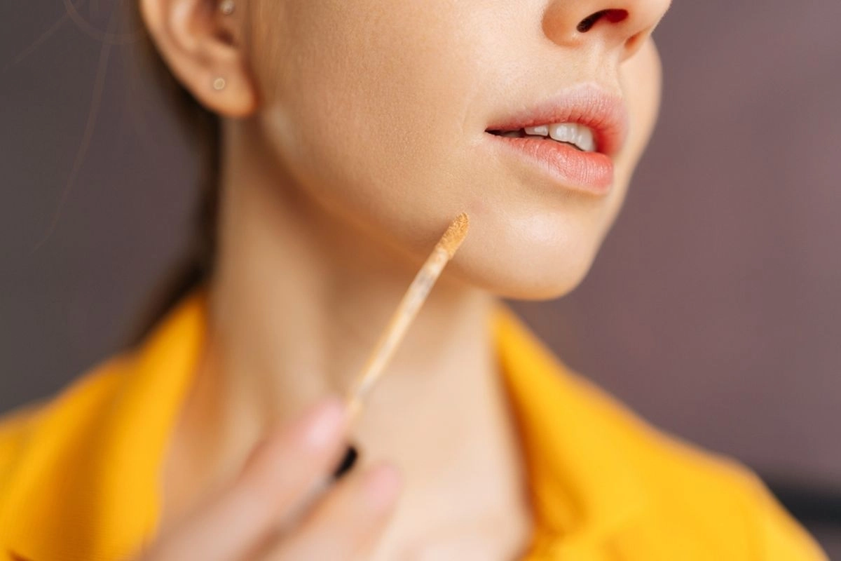 Jerawat Bisa Tambah Banyak Jika Sering Ditutupi Concealer