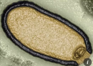 Picu Pandemi Baru yang Mengerikan, Para Ilmuwan Beri Peringatan Virus Zombi Arktik di Siberia 