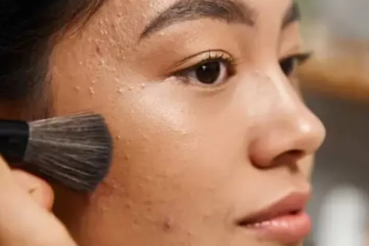 Ada Merkuri di Produk Kecantikan? Jangan Diabaikan, Ini Dampak yang Terjadi jika Wajah Terkena Merkuri