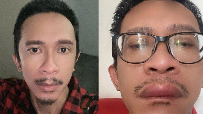 Jadi Perdebatan di Masyarakat, Aming Berharap Presiden Terpilih Bisa Sejahterakan Rakyat