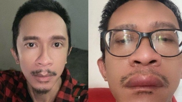 Jadi Perdebatan di Masyarakat, Aming Berharap Presiden Terpilih Bisa Sejahterakan Rakyat