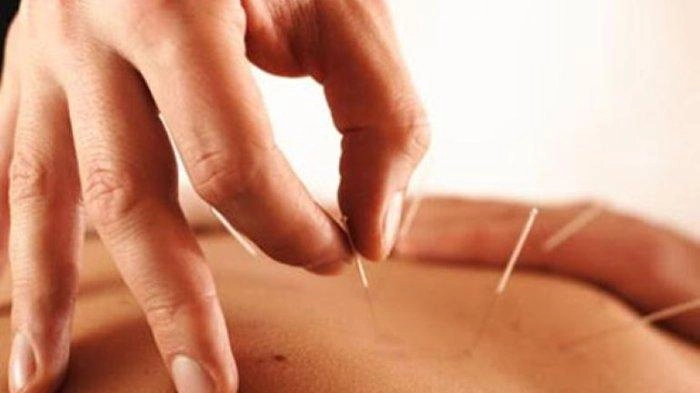 Akupunktur Bisa Digunakan sebagai Pengobatan Paliatif Kanker