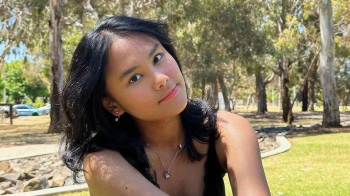 Mahasiswi yang Tewas Tertimpa Pohon di Australia Ternyata Alumni Universitas Udayana, Raih IPK 3,93