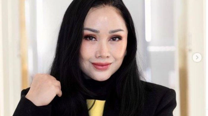 Titi DJ Jawab Biaya Operasi Anti Aging di Korea