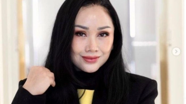 Titi DJ Jawab Biaya Operasi Anti Aging di Korea