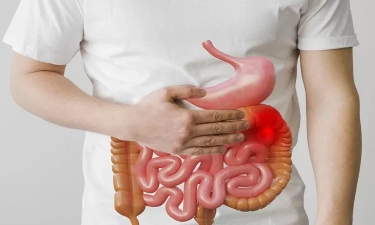 Mencegah Asam Lambung Naik: 10 Cara Efektif untuk Mengoptimalkan Kesehatan Lambung