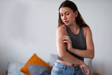 Cara Mengatasi Penyakit Kulit Eksim, Psoriasis, dan Dermatitis dengan Memperbaiki Kesehatan Metabolik 