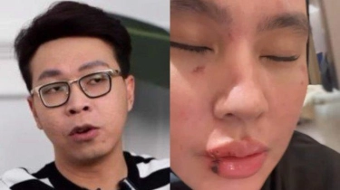 Lihat Kondisi Kartika Putri, Richard Lee Ungkit Kepahitan 2 Tahun Lalu, Singgung Hukum Paling Tinggi