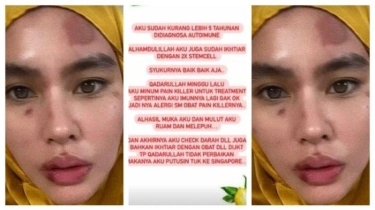 Sakitnya Kena Nyinyir hingga Richard Lee Singgung Azab, Kartika Putri Sindir Adab Sesama Manusia