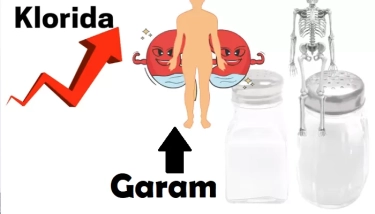 Bahaya Konsumsi Garam Secara Berlebihan dapat Menyebabkan Osteoporosis, Begini Penjelasan dr. Nova