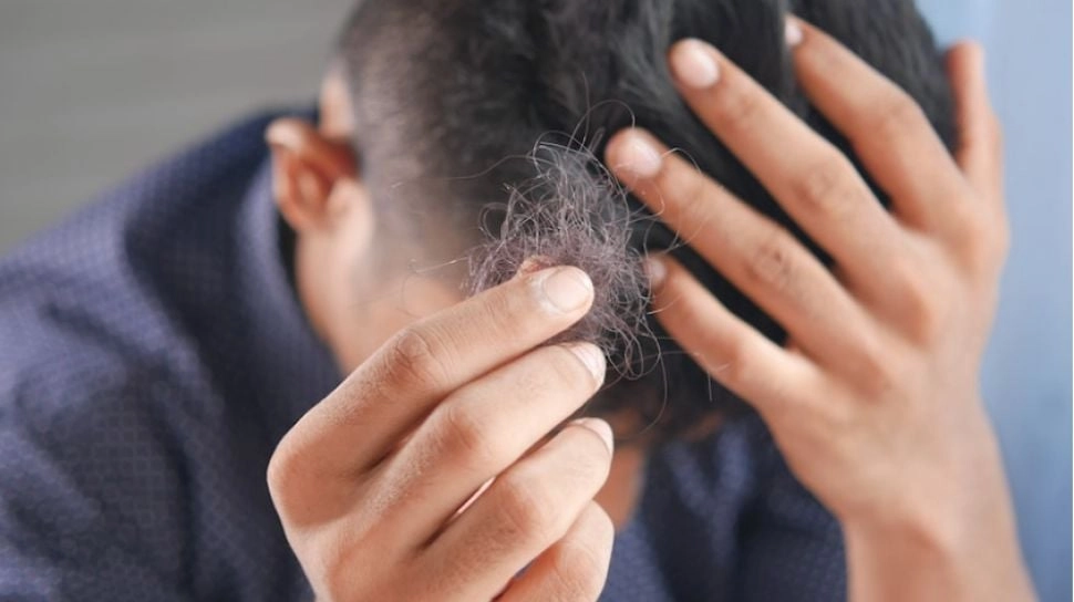 Waspadai Rambut Rontok hingga Sering Lelah dan Demam, Bisa Jadi Tanda-tanda Autoimun