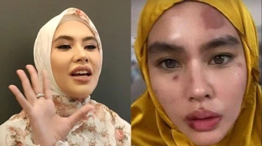 Sembuh dari Penyakit, Kartika Putri Minta Warganet Tak Percayai Tahayul: Kalau Komentar Pakai Ilmu