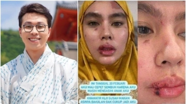 Kartika Putri Sebut Dokter Richard Lee Langgar Sumpah Dokter Usai Mengolok-olok Penyakitnya, Memang Isinya Gimana?