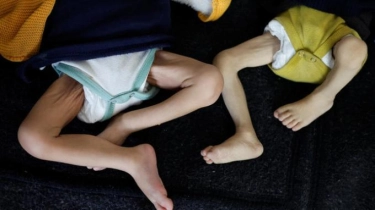 Satu dari 6 Anak Usia di Bawah Dua Tahun di Gaza Utara Alami Kurang Gizi Akut