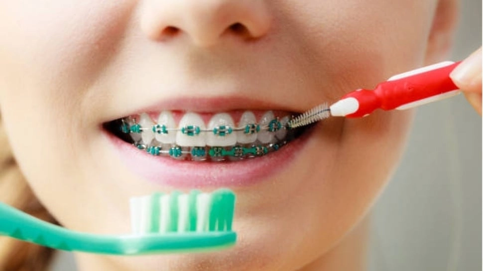 Harus Kontrol Behel saat Puasa, Apakah Bikin Batal?