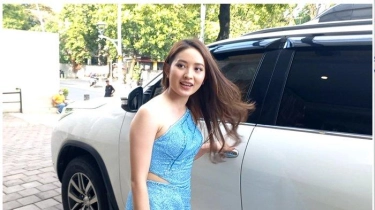 Natasha Wilona Heran Dituduh Operasi Plastik oleh Warganet 