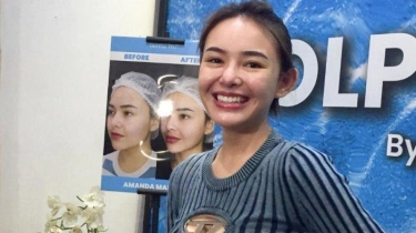 Berkat Diet, Amanda Manopo Sukses Turunkan Berat Badan Hampir 15 Kg