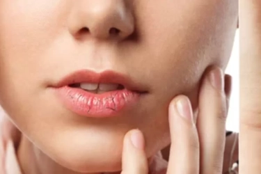 Catat! 6 Tips Agar Bibir Tidak Kering Saat Menjalankan Ibadah Puasa Seharian