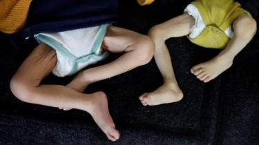 UNICEF Memperingatkan Kematian 23 Anak di Gaza Akibat Kekurangan Gizi Hanyalah Puncak Gunung Es