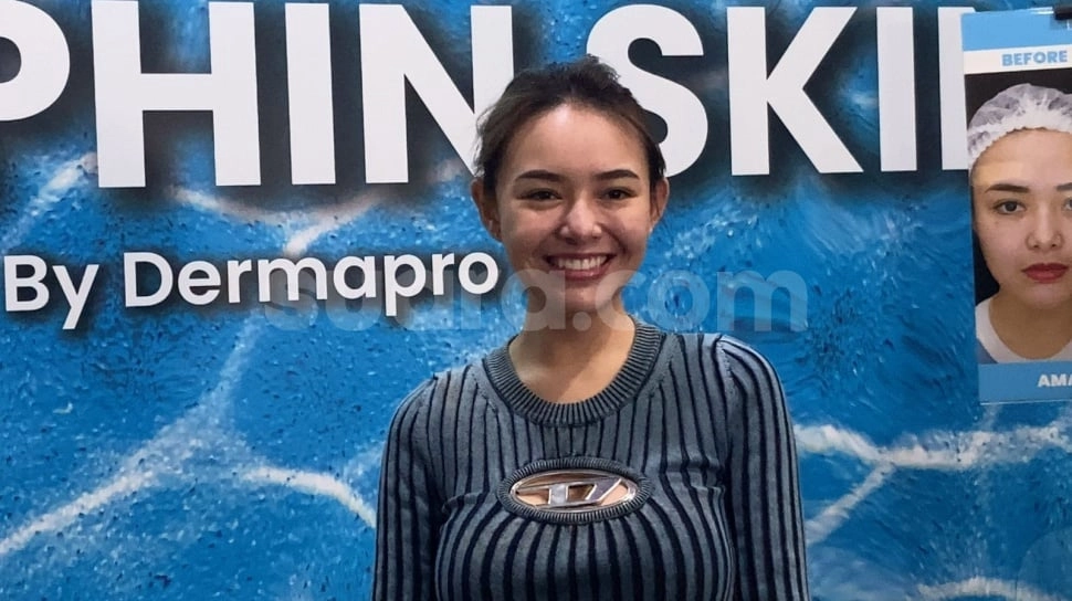 Berhasil Turunkan Berat Badan, Amanda Manopo Malah Diwanti-wanti: Plis Jangan..