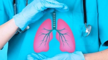 Penyebab Penderita TBC Kerap Gagal Jalani Pengobatan Sampai Tuntas