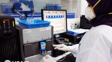 AS Danai Terapi Pencegahan TBC di Indonesia Senilai Rp 23 Miliar 