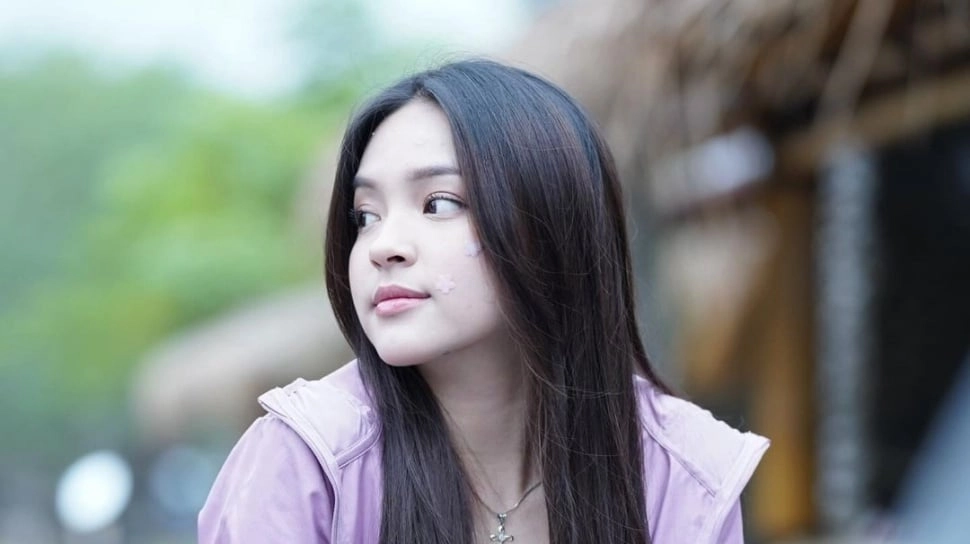 Fungsi Acne Patch yang Sering Dipakai Eca Aura, Bisa Bantu Jerawat Cepat Kering
