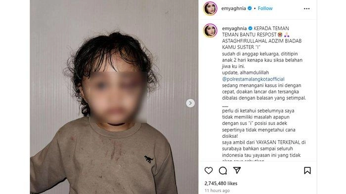 Anak Selebgram Aghnia Punjabi Diduga Dianiaya Pengasuh, Wajahnya Penuh Luka Lebam