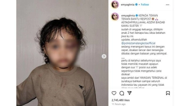 Anak Selebgram Aghnia Punjabi Diduga Dianiaya Pengasuh, Wajahnya Penuh Luka Lebam
