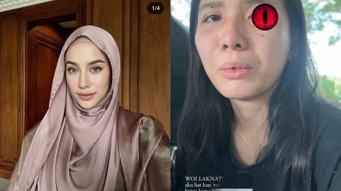 Kecurigaan Emy Aghnia yang Anaknya Dianiaya Pengasuh, Awalnya Dibilang Cedera Akibat Jatuh