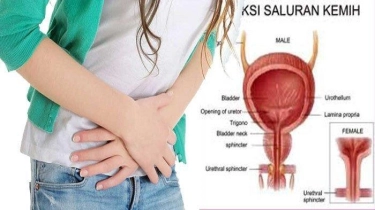 Perempuan Rentan Alami Infeksi Saluran Kemih, Ternyata Ini Alasannya 