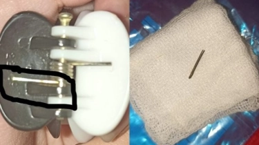 Viral Kronologi Cewek Jadi Korban Jeday Patah: Ngilu! Potongan Besi Menancap Mata