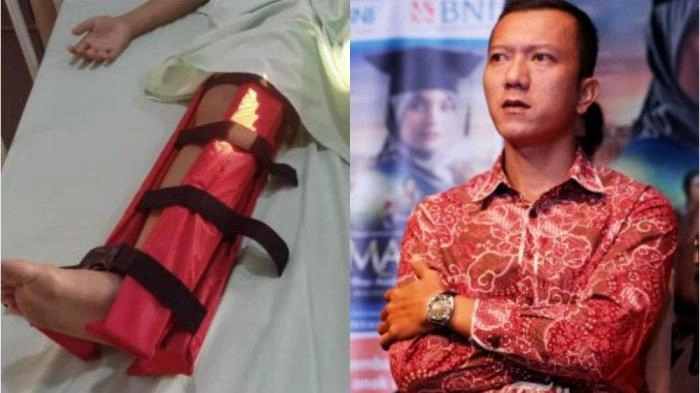 Kronologi 5 Keponakan dan Sepupu Teuku Rifnu Jadi Korban Tabrak Lari: Disisir Sekaligus