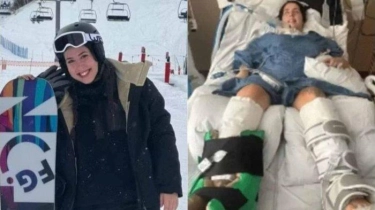 Sekaleng Sup Membuat Wanita Berusia 23 Tahun di Colorado AS Lumpuh Total, Infeksi Bakteri yang Fatal