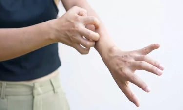 Gejala dan Cara Alami untuk Redakan Alergi Dingin Dimusim Hujan