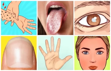 Jangan Diremehkan! 9 Sinyal Ini Menunjukkan Ada yang Tidak Beres pada Tubuhmu, Bisa Berakibat pada Kebutaan