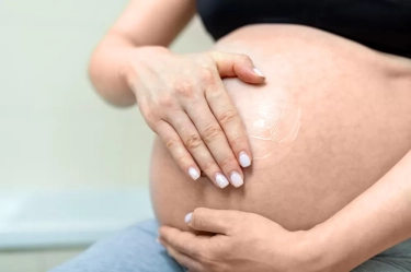 5 Rekomendasi Cream Penghilang Stretch Mark saat Hamil