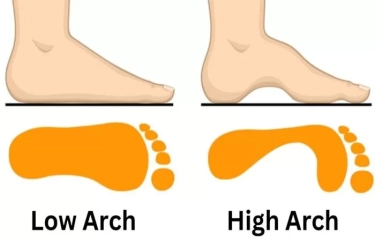 Tes Kepribadian: Lengkungan Kaki Dapat Mengungkapkan Sifat Seseorang, Nomor 2 Sangat Cerdas dan Ahli Membaca Pikiran Orang