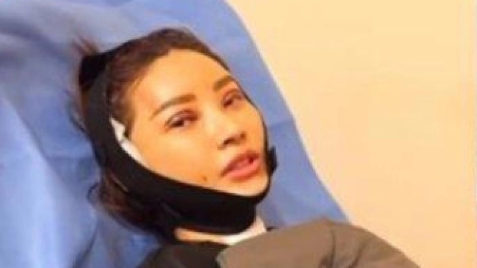 Potret Terbaru Sarwendah Usai Operasi Plastik, Netizen: Kok Jadi MIrip Inul Daratista?