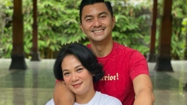 Dian Nitami Putuskan Operasi Plastik di Usia 53 Tahun Melalui Metode Face Lifting