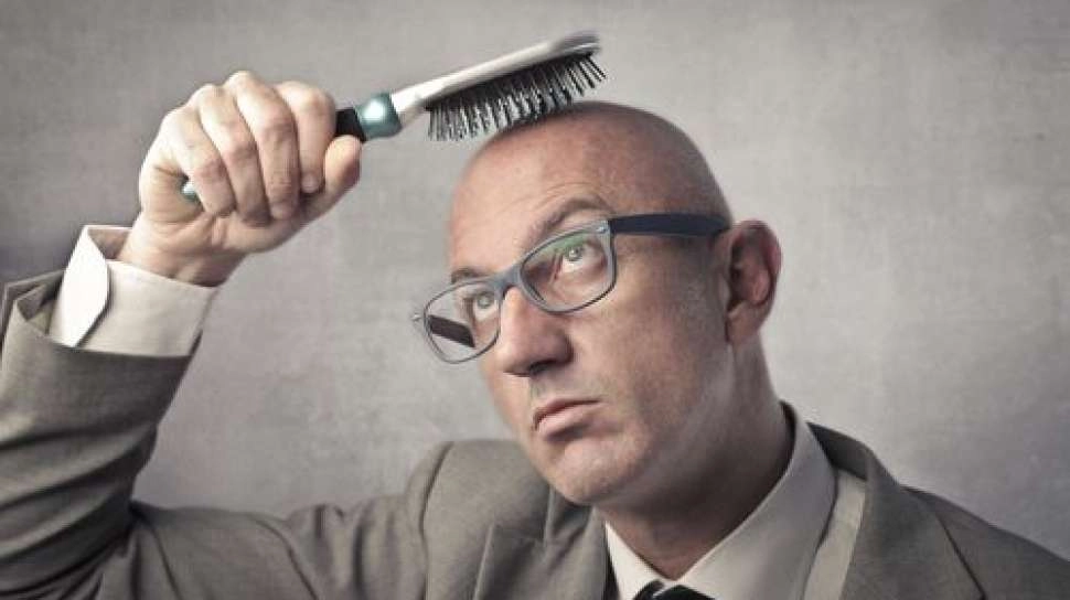Masih Muda Rambut Mulai Botak? Begini Cara Mencegah dan Mengatasinya