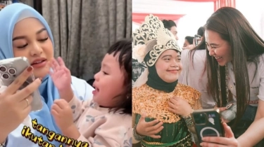 Dekil vs Kinclong: Begini Beda Casing iPhone Aurel Hermansyah dan Aaliyah Massaid, Berapa Harganya?