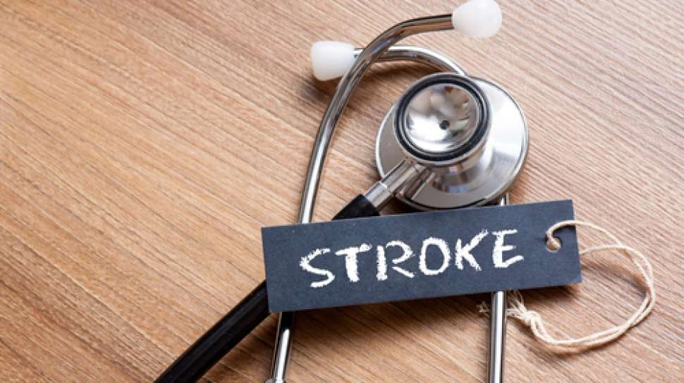 Kelainan Irama Jantung Picu Risiko Stroke Iskemik 5 Kali Lipat, Kenali Gejalanya!