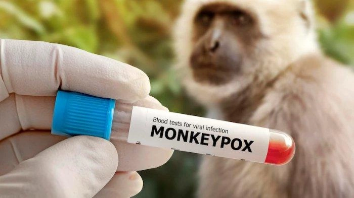Bukan Istirahat, Pasien Mpox Wajib Minum Obat, Ini Jenis yang Harus Dikonsumsi