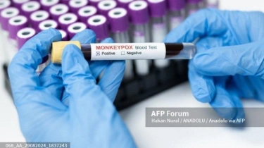 Apakah Langkah Pemerintah Sudah Tepat untuk Hadapi Mpox? Ini Kata Epidemiolog 