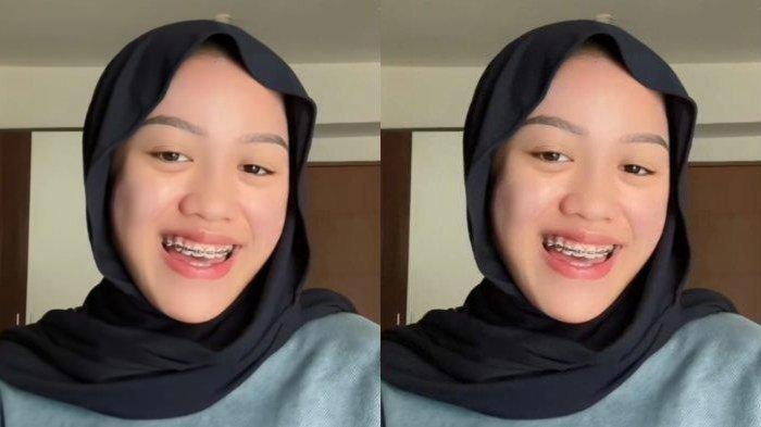 Penjelasan Lolly soal Hasil Testpack Garis Dua hingga Dituding Pernah Hamil