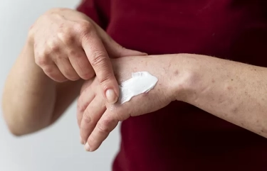 Rekomendasi Obat Pereda Gatal di Pantat Yang Dijual Bebas di Apotek dan Tidak Perlu Resep Dokter