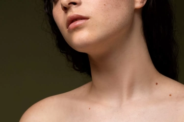 Simak Arti Letak Tahi Lalat di Leher untuk Pria dan Perempuan, Tanda Keberuntungan atau Kesialan?