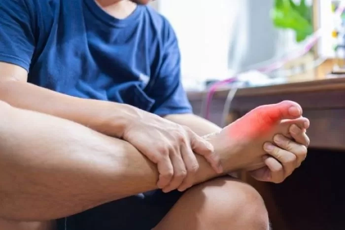 Tiga Faktor Penyebab Anak Muda Terkena Asam Urat